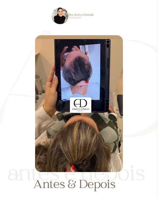 Cuidar da saúde do cabelo é entender a causa, avaliar o couro cabeludo e acompanhar cada etapa do tr