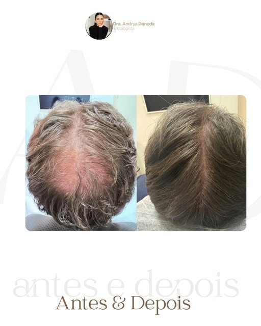 Esse é um daqueles casos que eu gosto de mostrar porque ele quebra um mito.

Esse paciente chegou co
