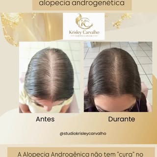 Não era ‘só queda’. Era o corpo tentando contar uma história que o couro cabeludo já sabia. 🌱✨
A al