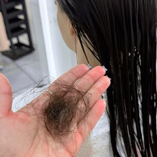 ✨ Cada fio conta uma história.

Essa paciente chegou ao Studio com queda capilar há anos, couro cabe