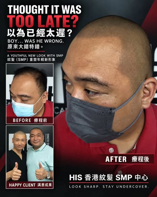 他一直以為，到了這個人生階段，現在才尋找脫髮解決方法，可能已經太遲。

多年來，他已經慢慢接受脫髮的事實，亦以為再沒有方法可以為自己重塑自然、年輕而精神的外觀。

直至紋髮（SMP）找上了他……

原