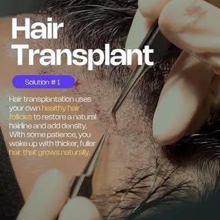 Hair loss is something that more and more people are experiencing in their everyday lives. You’re pr