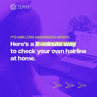 And because it's hair loss awareness month, here's a little take-home tip for those in doubt. If you
