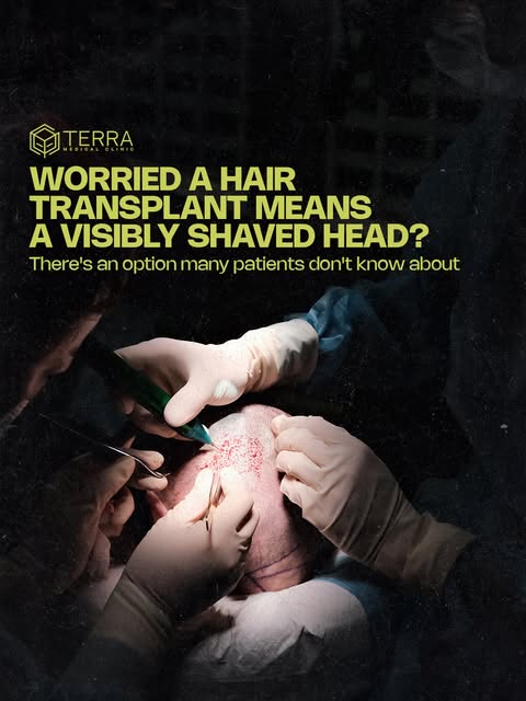 Worried a hair transplant will leave you with a visibly shaved head? It doesn't have to. 👇

Window 