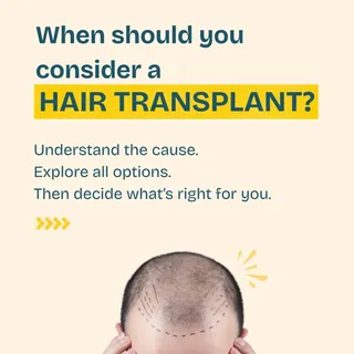 Thinking about a hair transplant? 🌱
A transplant can be a great option—but timing and candidacy mat