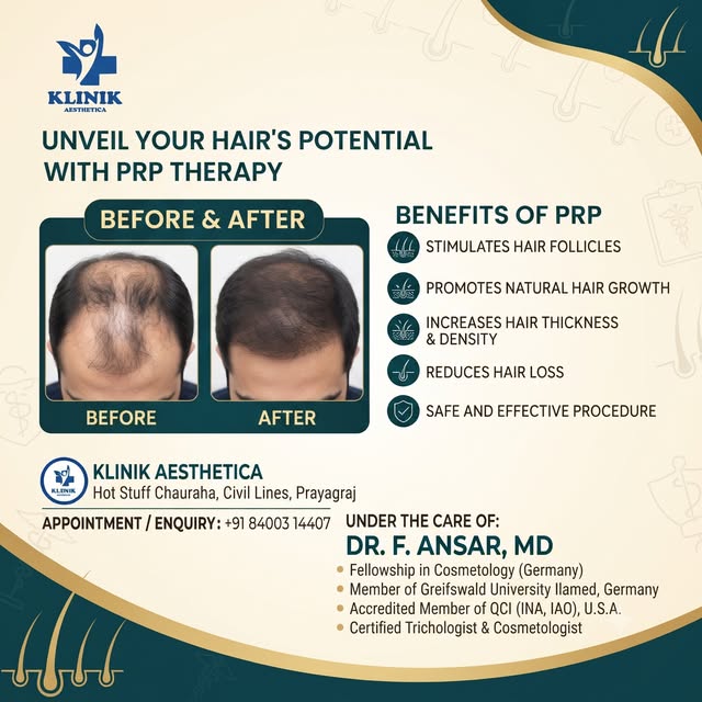 Unveil your hair's true potential with advanced PRP Therapy at Klinik Aesthetica, Prayagraj! ✨ Say g