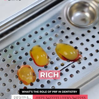 🦷 Did you know your own blood can help your mouth heal faster after dental treatment?

At Hash Clin