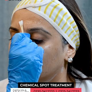 Chemical Spot Treatment for Pigmentation & Dark Spots ✨

Dark spots, pigmentation, and uneven skin t