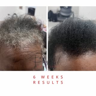 Look at this incredible transformation in just 6 weeks! ❤️We’re so proud of our client’s progress he