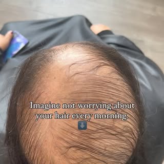 Wake up with hair that’s ready to roll? Yep, it’s totally possible. Here’s the deal: Non-Surgical ha