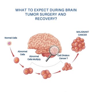 During brain tumor surgery or craniotomy, neurosurgeons carefully remove the tumor to avoid damaging