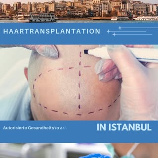 #Haartransplantation in der Türkei