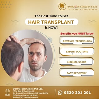 Tired of hair loss? 🤷🏻‍♂️
 Worried & conscious about your visible scalp? 🙍🏻‍♂️

If you're lookin