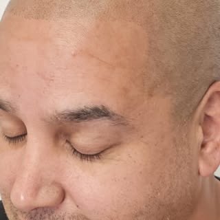 Scalp Micropigmentation (or "SMP") is a specifically designed and modified form of tattooing that is