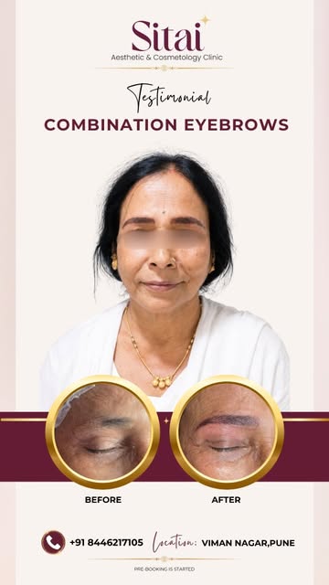 When the results are this good, even moms can’t resist! 

​Our client’s daughter got her eyebrows do