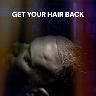 🌟 Welcome to Hair World Turkey – The Ultimate Hair Transplant Clinic!

💡 Founded in 2014, we are a