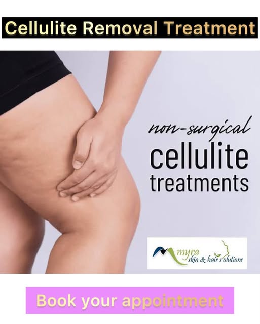 Cellulite Treatment