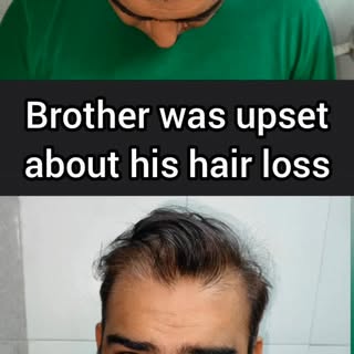 “Not just a hair transplant, a brotherhood upgrade.”