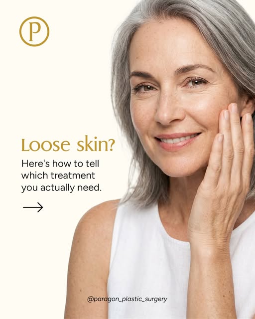 Skin tightening has more options than ever, and the hard part is matching the right one to how much 