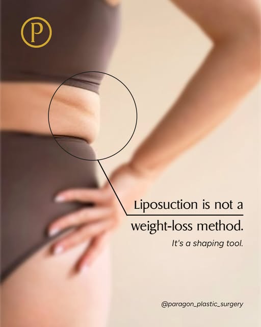 Liposuction is designed to sculpt and refine your shape by removing stubborn pockets of fat that can