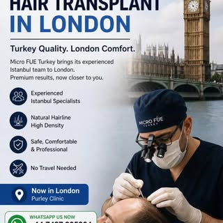 Hair Transplant in London – No Need to Travel to Turkey 🇬🇧
Looking for a hair transplant in London