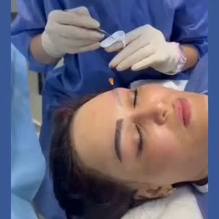 ✨ Eyebrow Transplant in Istanbul, Turkey | Natural & Permanent Results

Thin, uneven, over-plucked o