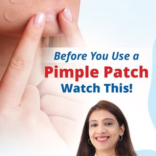 Some pimples can benefit from a pimple patch, but there’s a catch 👀

Hydrocolloid patches can help 
