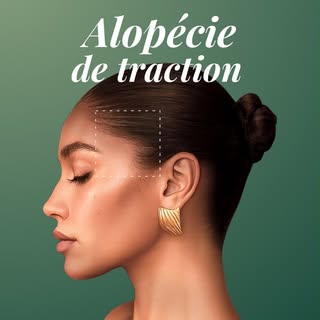 La perte de cheveux n’est pas toujours uniquement liée à la génétique.

Des coiffures trop serrées, 