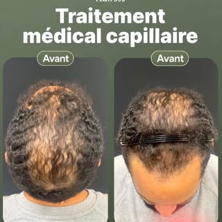 Des résultats visibles.
Un traitement médical adapté à votre situation.

👉 Diagnostic précis, suivi