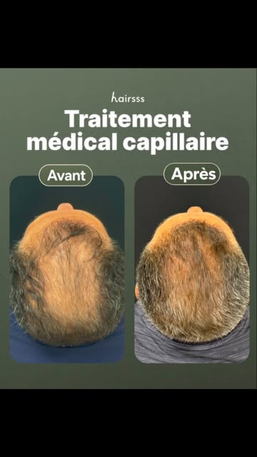 Des résultats visibles.
Un traitement médical adapté à votre situation.

👉 Diagnostic précis, suivi
