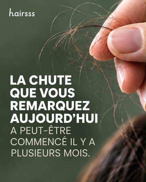 Toutes les chutes de cheveux ne sont pas simplement saisonnières.

Ce que vous remarquez aujourd’hui