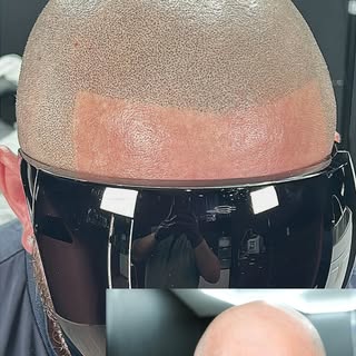 Antes vs Después… la diferencia es REAL. 🔥
Así se ve una línea frontal bien diseñada con SMP.
Menos