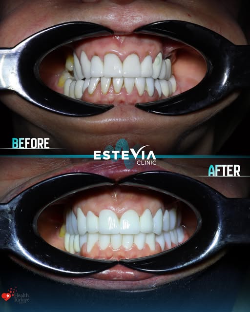 A journey to a renewed smile, renewed confidence, and a brand-new chapter. ✨

Julie travelled to Est