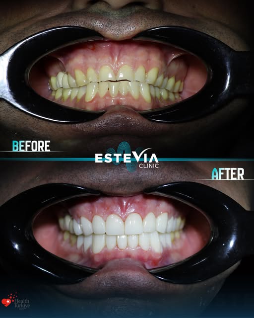 A journey to a renewed smile, renewed confidence, and a brand-new chapter. ✨

Antonio  travelled to 
