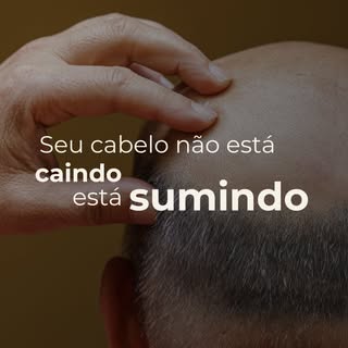Calvície é um processo silencioso de “encolhimento”. 

O fio muitas vezes não cai…ele vai afinando a