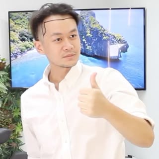 zh: Tom医生从台湾来到我们诊所进行植发手术。现在，让我们一起回顾Tom医生的植发过程。
敬请期待Tom医生的术后过程和最终效果。🙂

eng: Dr.Tom visited our clini