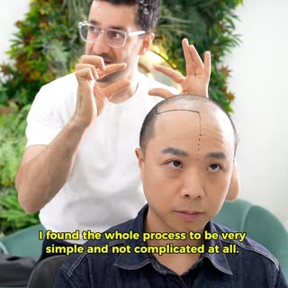 ~EHC~ 

▫️Hair transplant
▫️Eyebrow transplant
▫️Beard Transplant
▫️Unshaven Hair Transplant
▫️DHI H