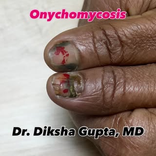Is it just a bruised nail, or something more? 🔍
Many of us ignore changes in our nails, but your ha
