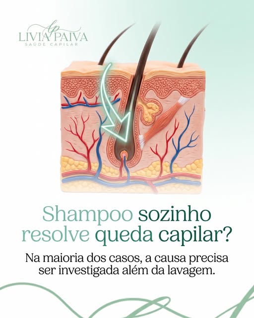 Trocar de shampoo é uma das primeiras atitudes de quem percebe queda, porque parece uma solução simp