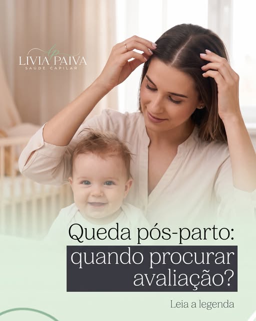 Depois do parto, muitas mulheres se assustam ao perceber um aumento importante de fios caindo. Alter