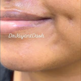 A smile that leaves a lasting impression. 😊✨
Here’s a look at the natural, dynamic results followin