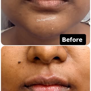 Precision, balance, and natural elegance. 💋✨
From subtle and understated to full, natural balance. 