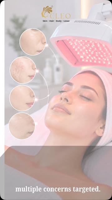 ✨ One glow. Two sessions. Zero extra cost.
Target acne, dullness, uneven tone & support collagen wit
