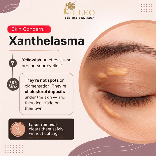 👀 Those yellow patches around your eyes… are you sure they’re pigmentation?

What if they’re actual