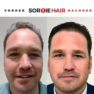 Es liegt in Ihrer Hand, Ihre Traumhaare zu erreichen! Wir möchten während Ihrer Veränderungsreise an