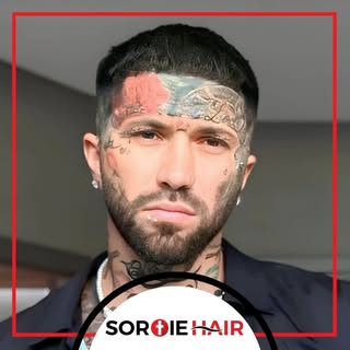📌Der berühmte Hip-Hop-Musiker Kendrick entschied sich nach langer Recherche für eine Haartransplant