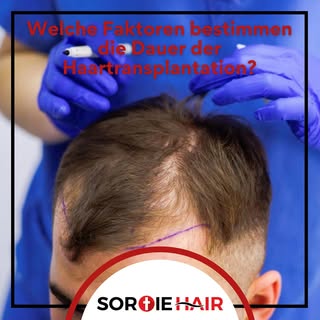 ❓Welche Faktoren bestimmen die Dauer der Haartransplantation?
👉 Größe des kahlen Bereichs, in dem e
