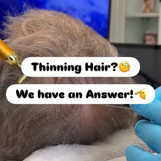 Hair loss isn’t only about growing new hair - it’s also about protecting the hair you still have ✨

