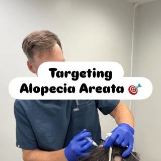 When alopecia areata causes sudden, patchy hair loss, targeted treatment can make a difference 💉

K