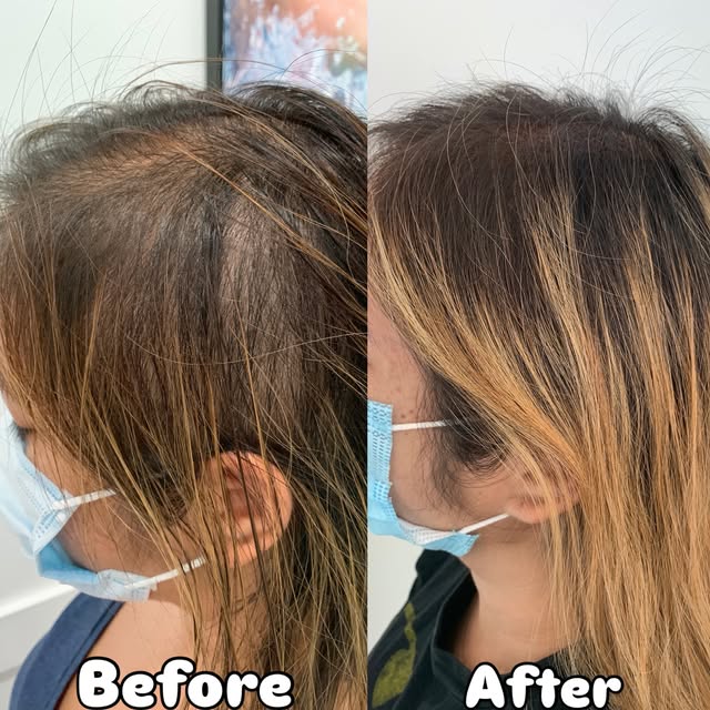 Hair confidence hits different when you can actually see the progress ✨

From noticeable thinning to